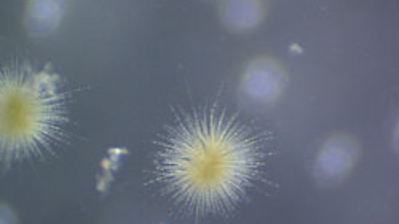 Algal Blooms in Wisconsin